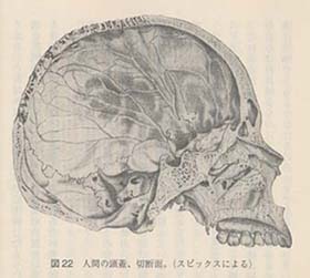 ���W���C�ؒf��